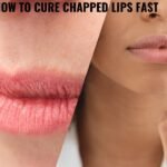 How To Cure Chapped Lips Fast