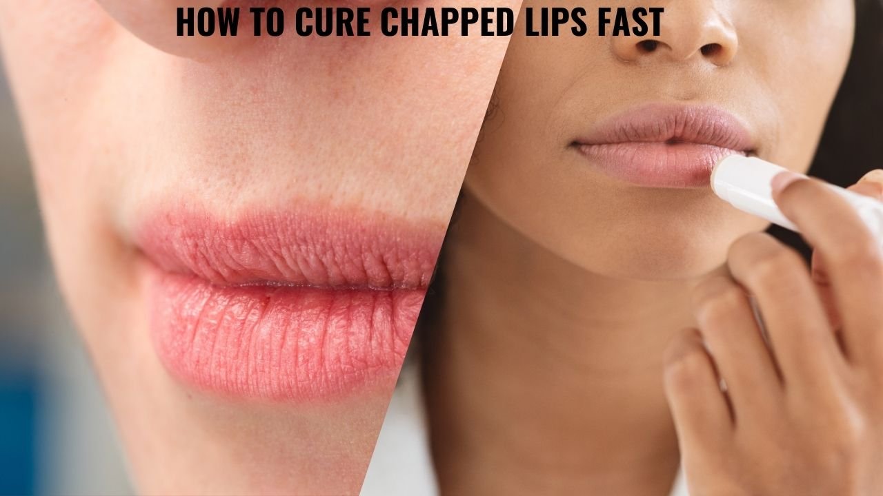 How To Cure Chapped Lips Fast